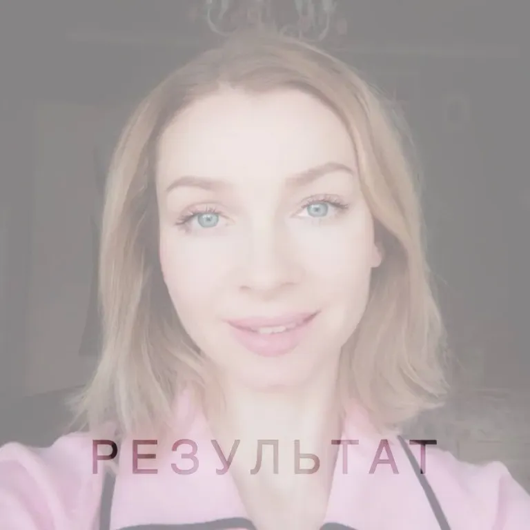 Результат моей пациентки спустя полгода!